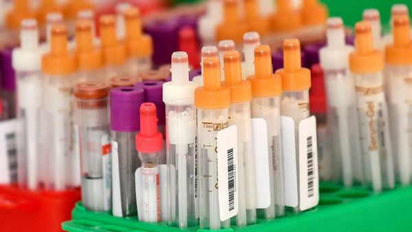 德国一医院发现新型变异毒株：不同于英国、南非和巴西