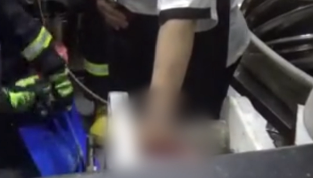 视频 | 触目惊心！一女子遭搅面机“咬手”消防员现场破拆