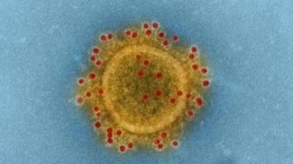 现在新冠病毒是什么病毒 20201020080854416094.jpg